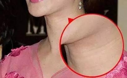 脖子有頸紋的女人面相解讀