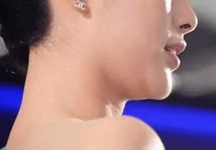 重下巴的女人面相分析，女人為什麼會出現重下巴？