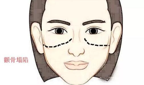 顴骨低的女人面相分析,顴骨低的女人面相好不好?