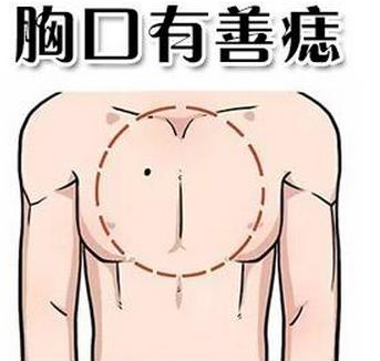 好運痣長痣在什麼位置 嘴角兩邊偏下長痣是什麼意思