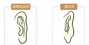 耳相16種圖解 各種耳朵形狀看富貴命運