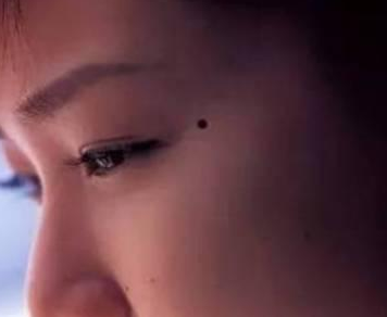 容易離婚的痣 長在左眼下方