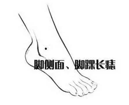 腳上有痣代表什麼 腳踝長痣好不好