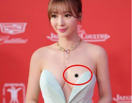 女生胸前長痣代表什麼 長中間和外側好不好