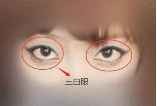 什麼是上三白眼，上三白眼的女人面相解析