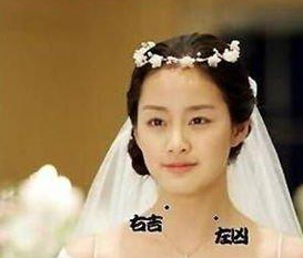 脖頸痣的位置與命運 脖子前邊長痣獨斷專行