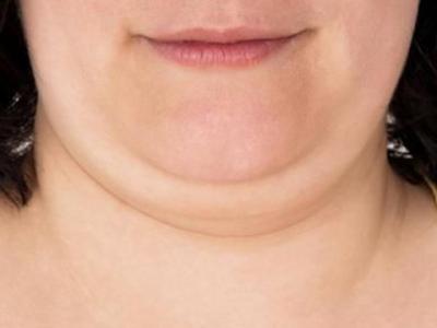女人雙下巴面相詳解，雙下巴女人的運勢如何？