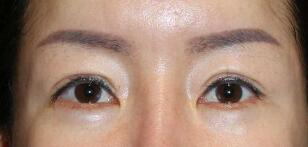 女人外眼角下垂是什麼原因，這種面相說明什麼？