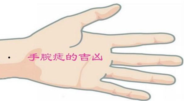 手腕有痣代表什麼 左手和右手代表的意思不一樣