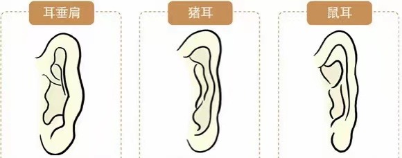 耳相16種圖解 各種耳朵形狀看富貴命運