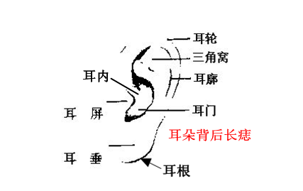 男人耳朵上長痣代表什麼 不同位置面相是怎樣的