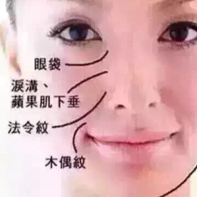 法令紋上的痣代表什麼 旁邊有痣說明什麼