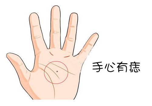 男人手掌有痣代表什麼   女人手掌有痣代表什麼