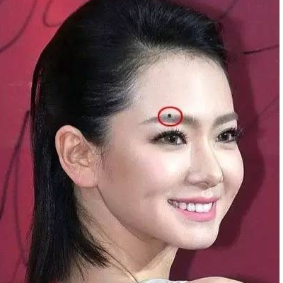 貴婦痣在哪裡 下巴長痣是什麼面相