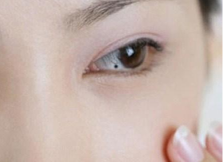 二婚痣長在哪裡 眼白耳屏人中