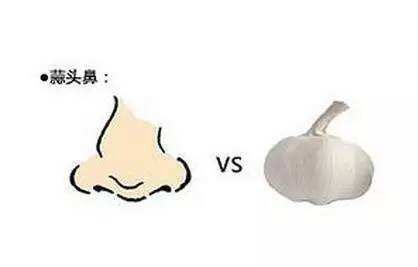 什麼是蒜頭鼻，蒜頭鼻面相怎麼樣？