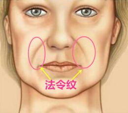女人有法令紋的面相好不好,法令紋入口代表了什麼?