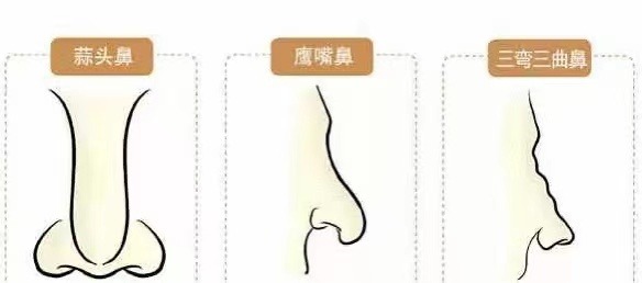 14種鼻型圖解 最全鼻子看相解讀命運