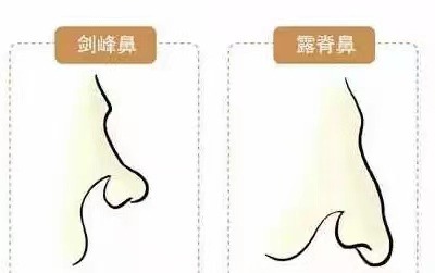 14種鼻型圖解 最全鼻子看相解讀命運