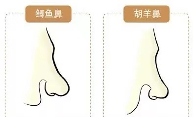 14種鼻型圖解 最全鼻子看相解讀命運