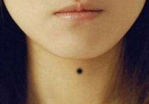 女人脖子上有痣好不好 不同位置代表什麼
