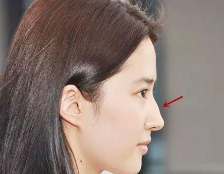 女人駝峰鼻面命運解釋駝峰鼻女人是旺夫命嗎?