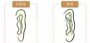 耳相16種圖解 各種耳朵形狀看富貴命運