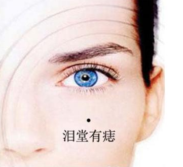 男人克妻痣長在哪裡 點了能不克妻嗎