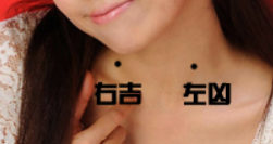 常見30種身上痣 影響婚姻財運
